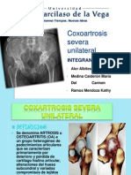 Coxoartrosis Severa Unilateral