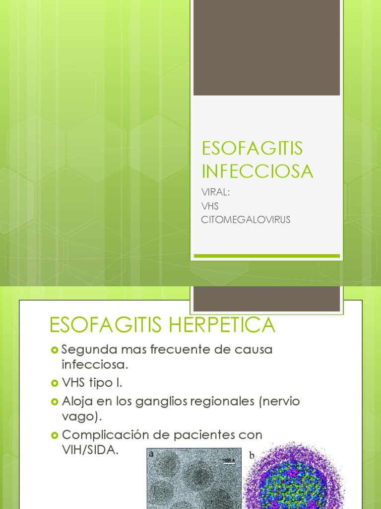 Esofagitis Infecciosa | PDF | Medicina | Medicina