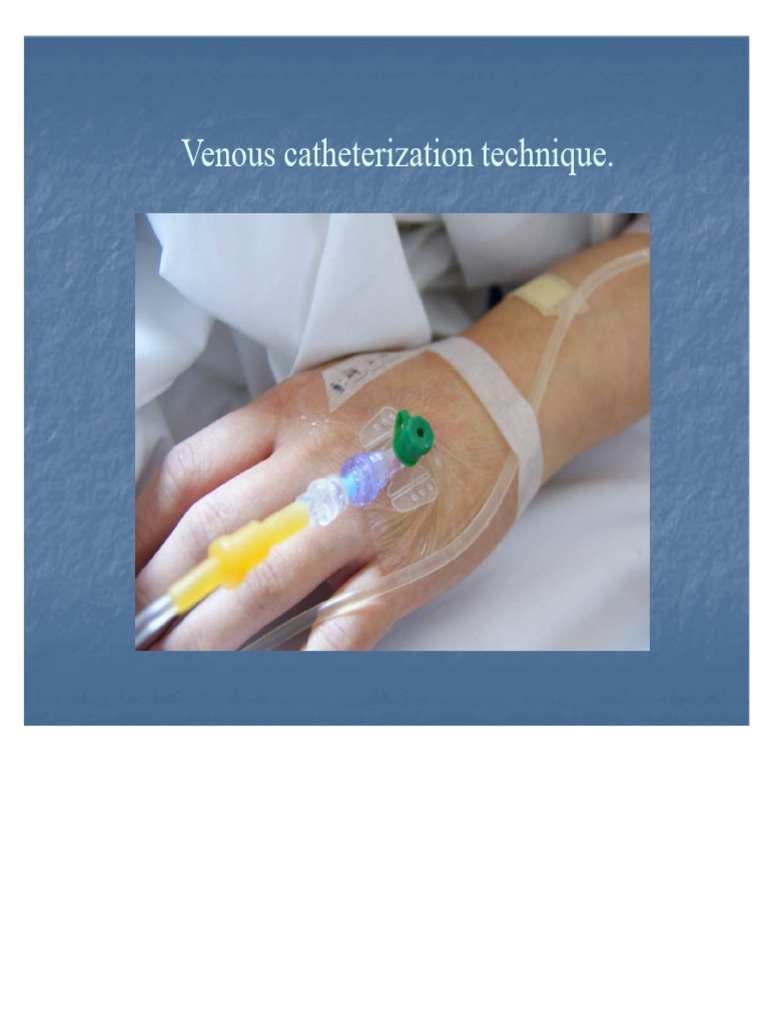 Venous Catheterization Procedure Guide | PDF | Intravenous Therapy | Vein