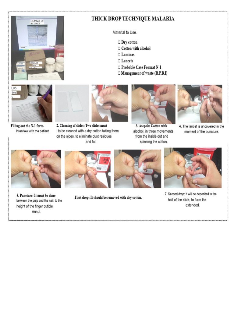 Thick Drop Technique for Malaria Testing | PDF