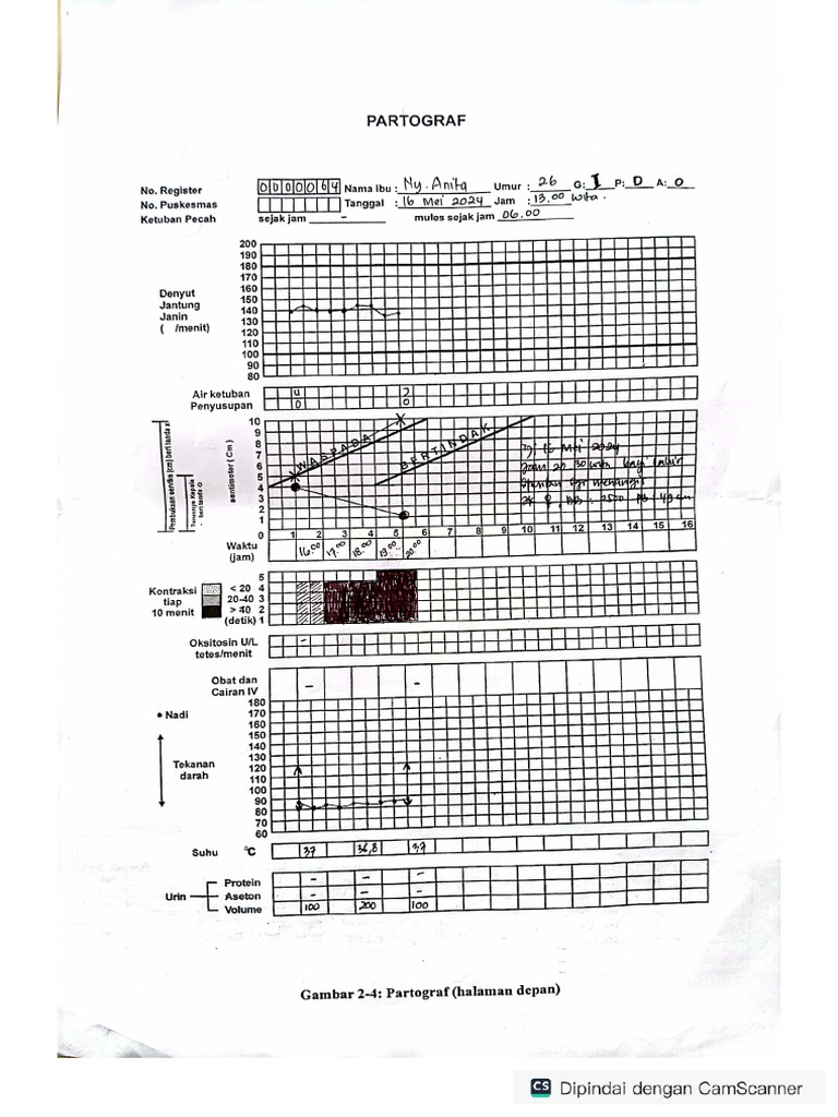 PARTOGRAF | PDF