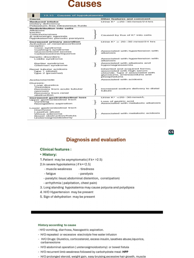 Hypokalemia Written | PDF