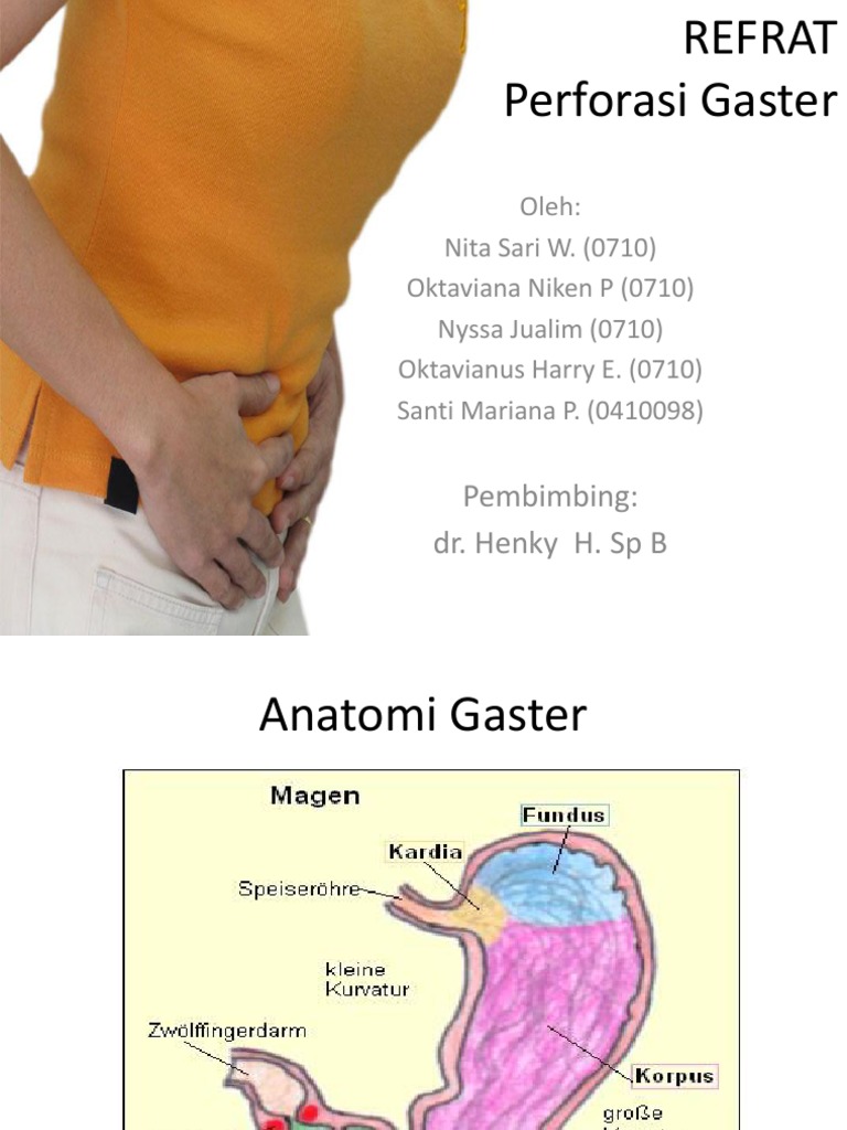 Perforasi Gaster PDF