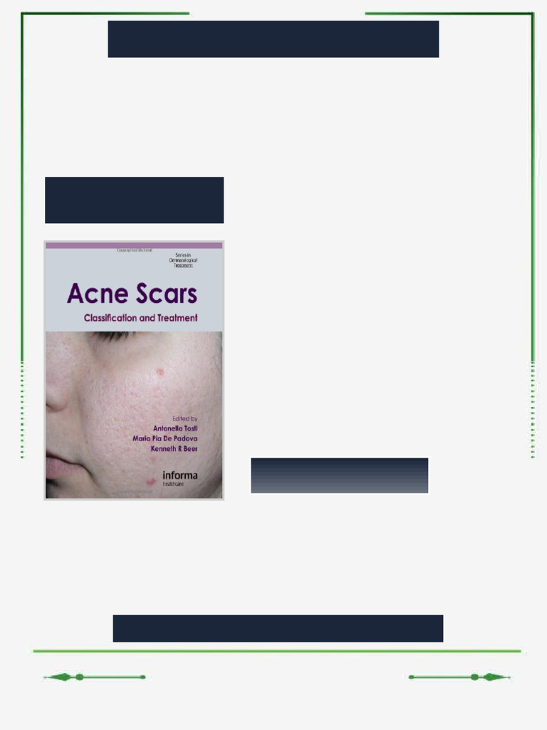 Acne Scars Classification and Treatment Series in Dermatological ...