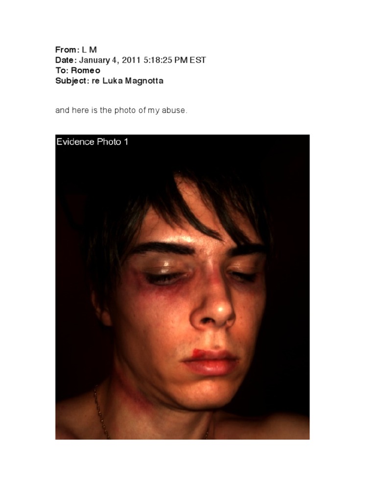 Amulya Sex Videos Come - Luka Magnotta | PDF | Psychiatric Hospital | Rape