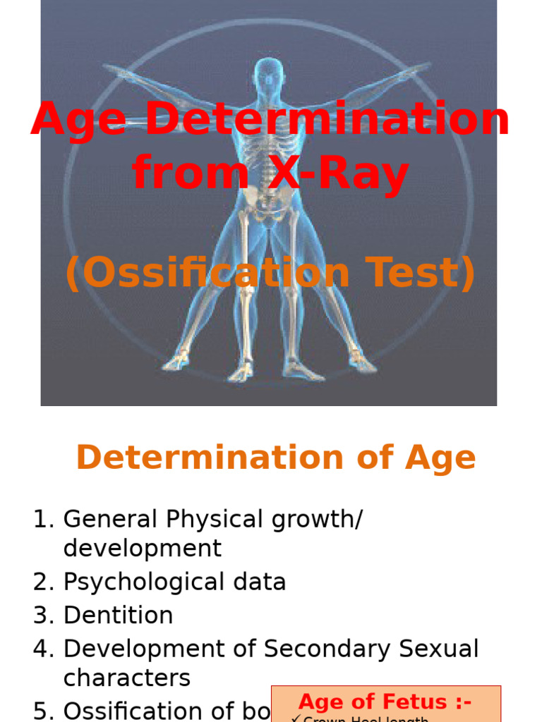 Age Determination via X-Ray Analysis | PDF | Limbs (Anatomy) | Skeletal ...