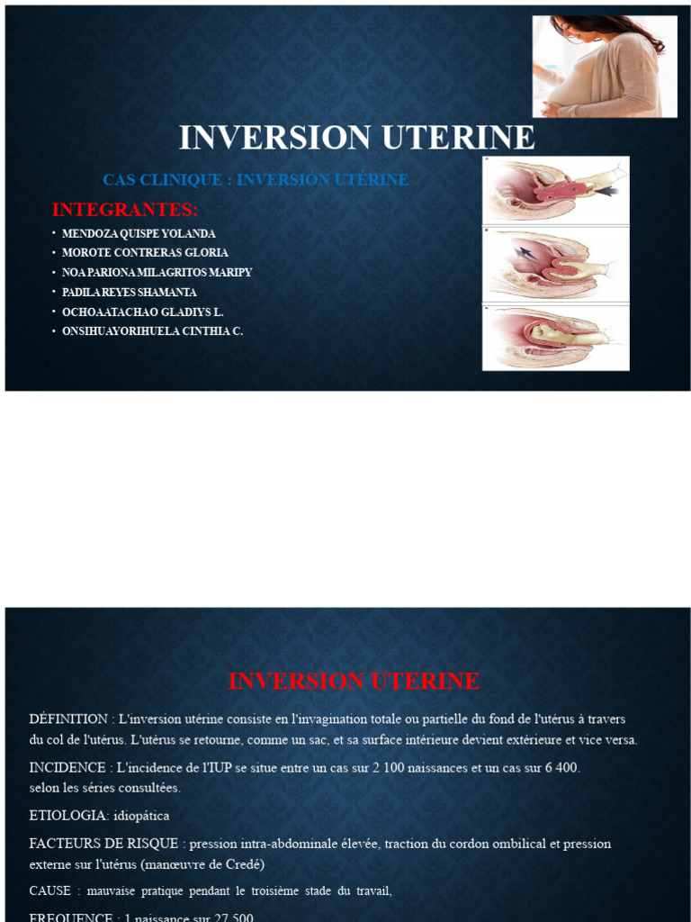 Inversion Utérine | PDF