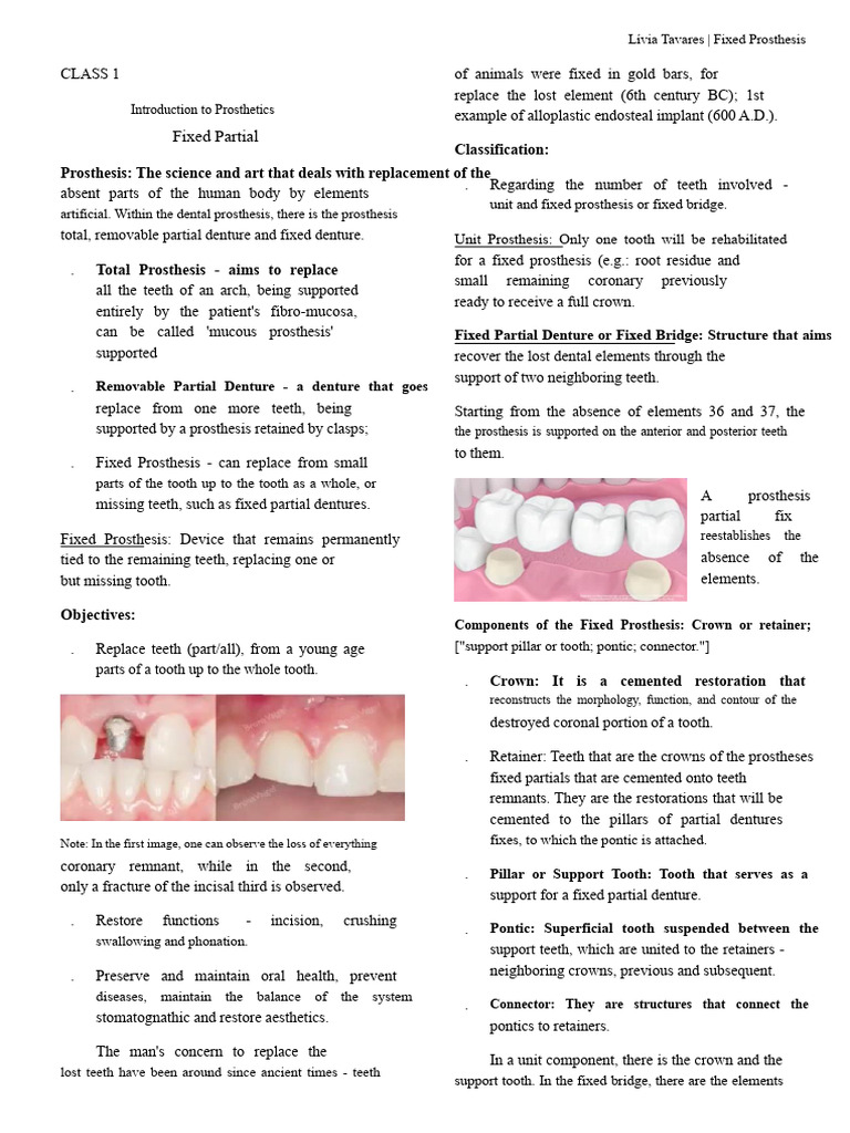 Overview of Fixed Prosthesis Types | PDF | Dentures | Tooth