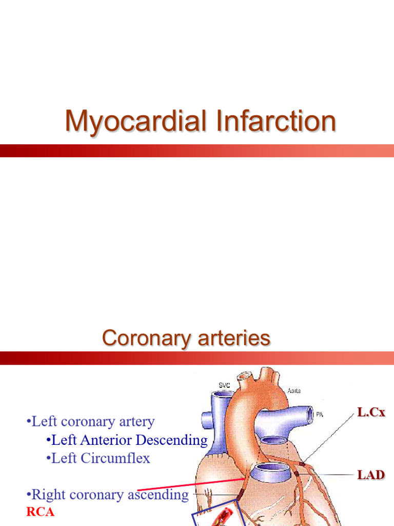 MI | PDF | Atherosclerosis | Myocardial Infarction