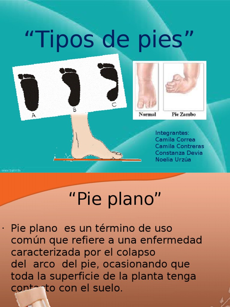 Pie Plano PDF Pie Enfermedades y trastornos