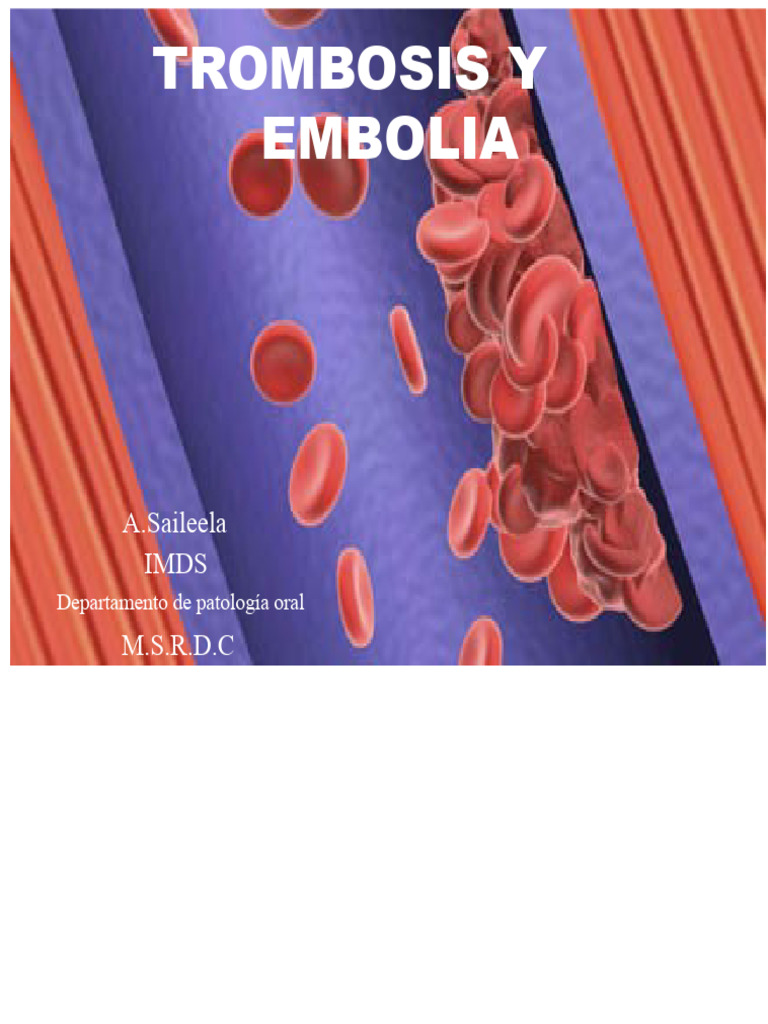 Trombosis y Embolia | PDF | Embolia | Trombo