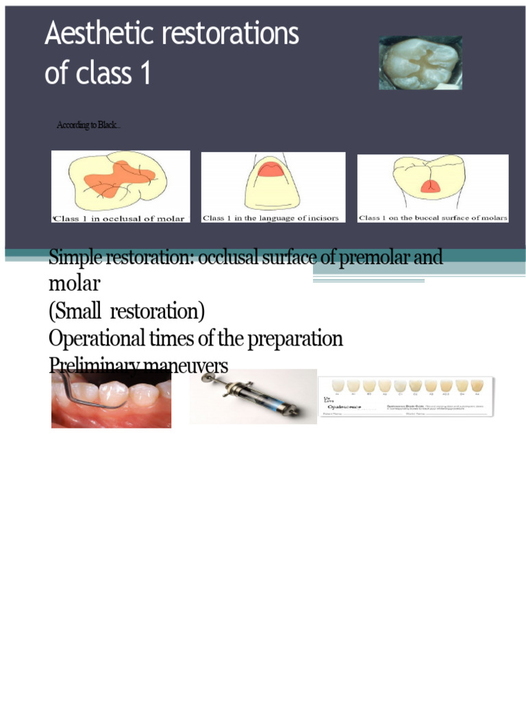 Class 1 Aesthetic Dental Restorations Guide | PDF | Dentin | Mouth