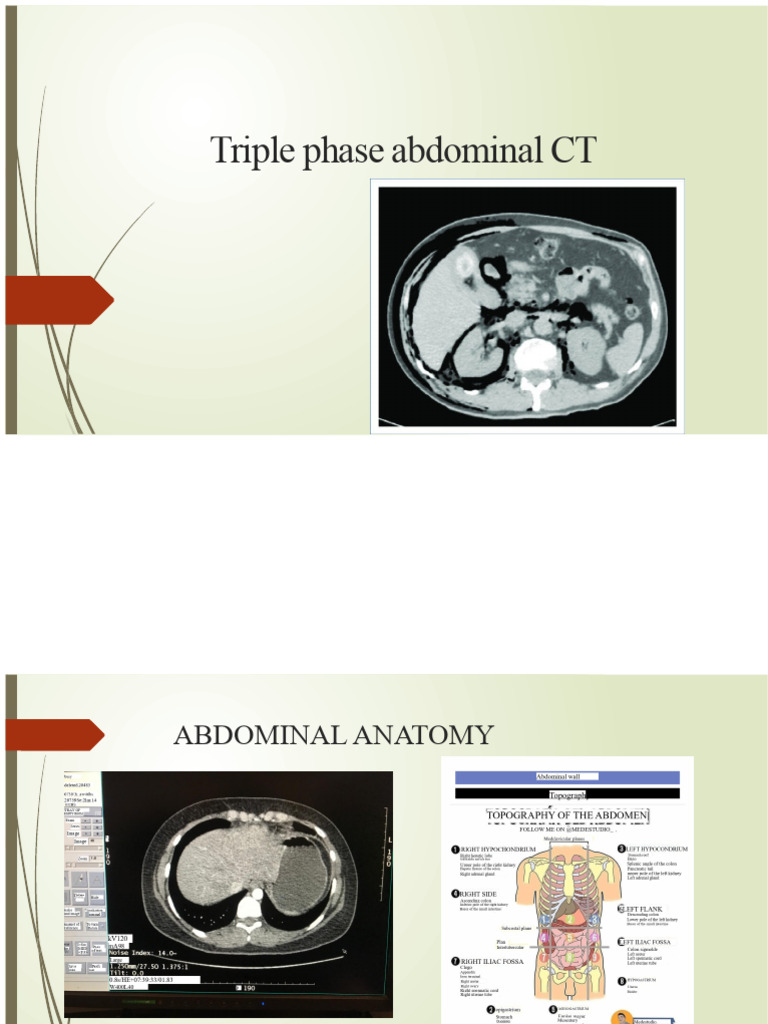 Triple Phase Abdominal CT | PDF