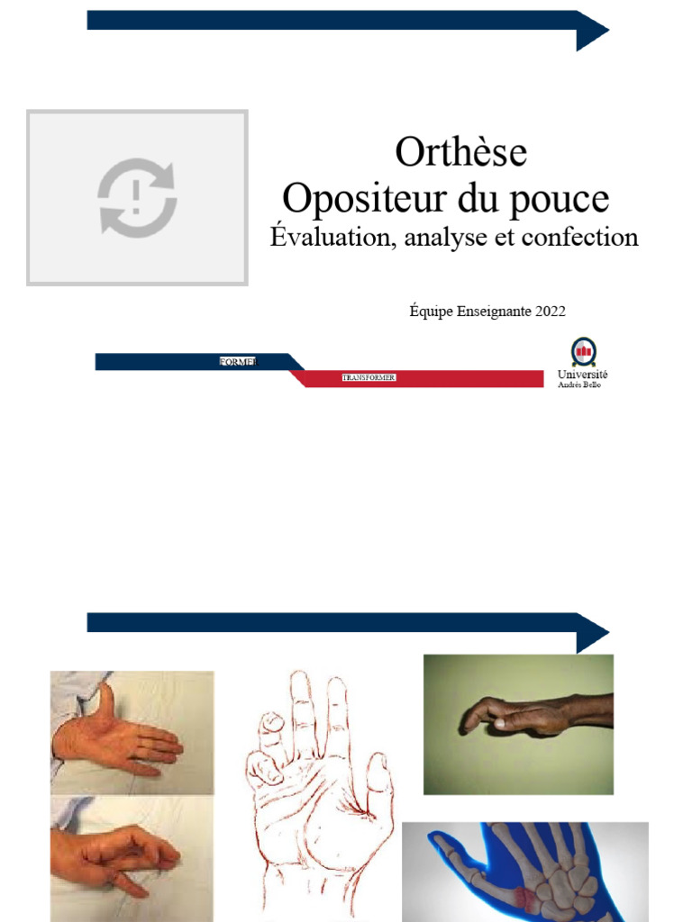 Orthèse Oposante du Pouce : Guide Complet | PDF | Articulation ...