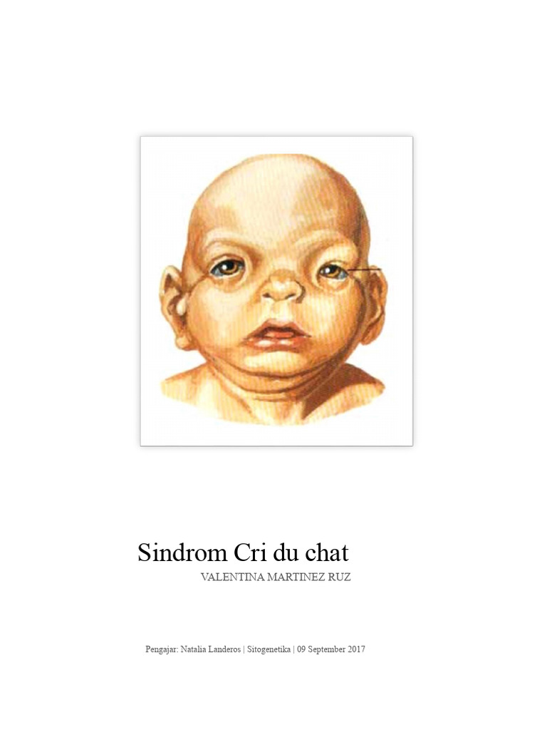 Sindrom Cri du Chat Penyebab dan Gejala PDF — free download