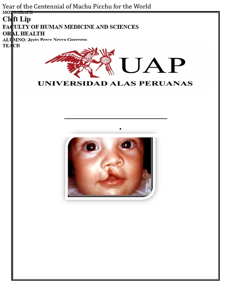 Understanding Cleft Lip and Palate | PDF