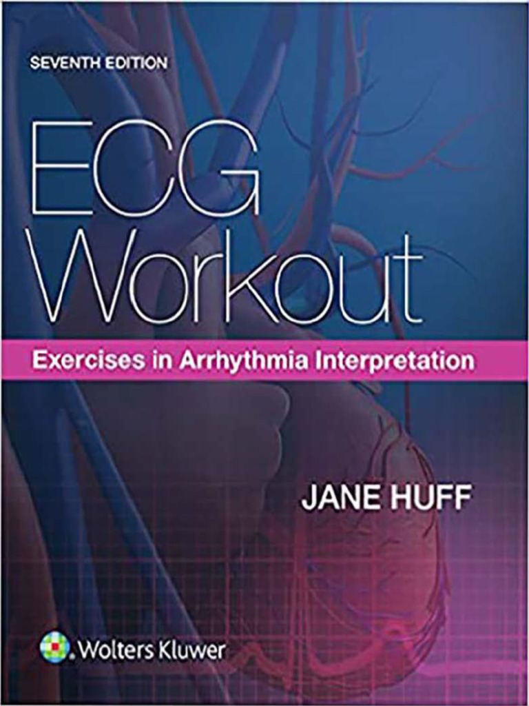 ECG Exercises for Arrhythmia Training | PDF | Heart Valve | Coronary ...