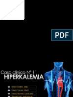 Hiperkalemia FP