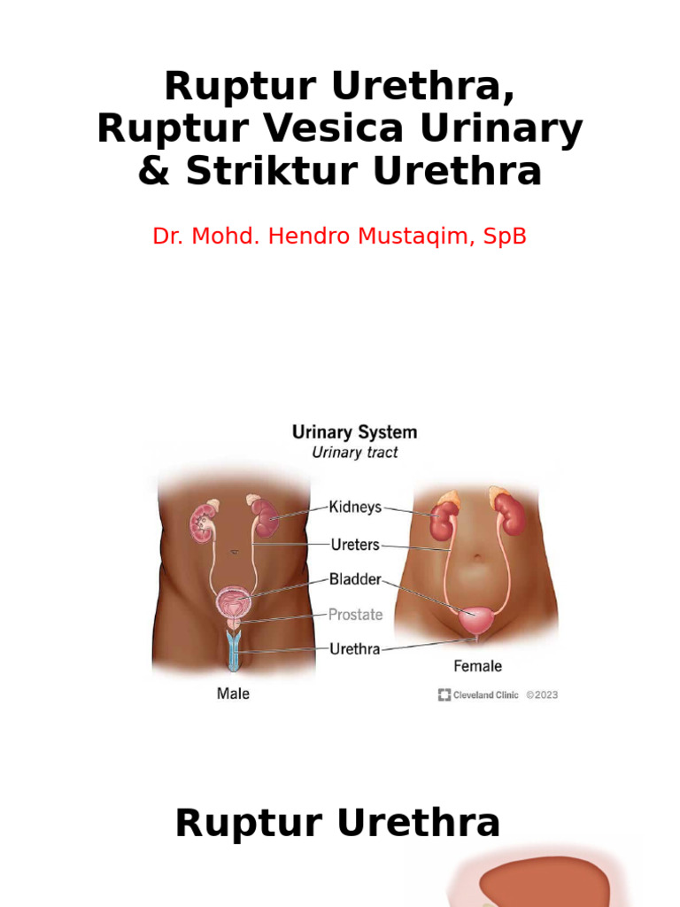 Rupture Urethra, Rupture Vesica Urinary & Stricture | PDF