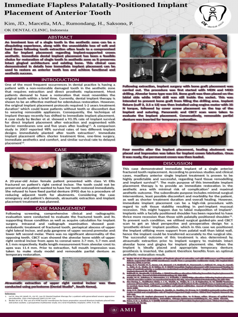 Flapless Immediate Implant for Anterior Tooth | PDF | Dental Implant ...