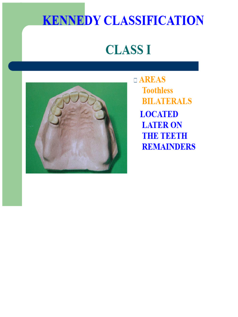 KENNEDY CLASSIFICATION 1 | PDF | Dentistry Branches | Dental Anatomy