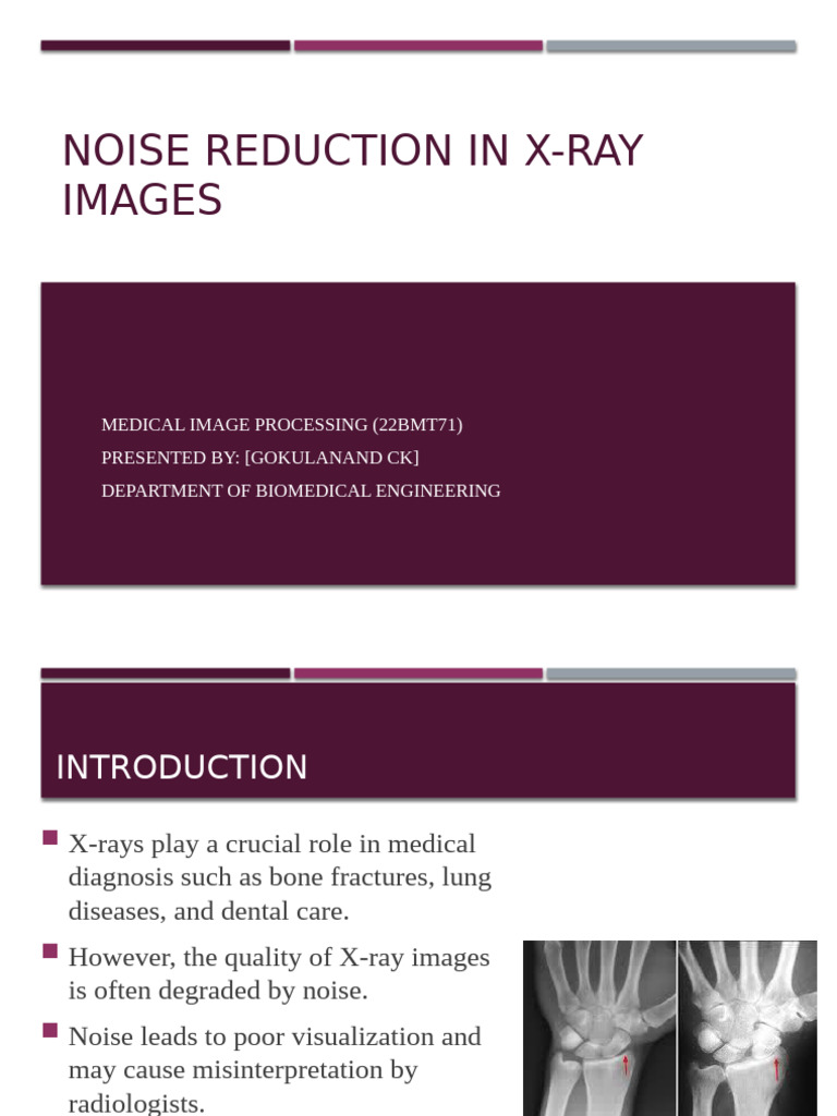 X-Ray Image Noise Reduction Techniques | PDF | Signal Processing | Imaging