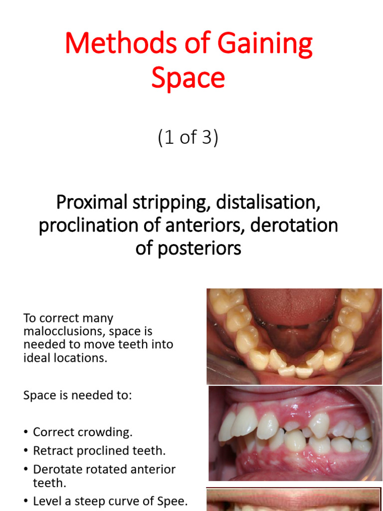 Methods of Gaining Space (1 of 3) - Proximal Stripping, Distalisation ...