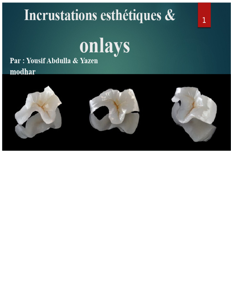 Guide complet sur les Inlays et Onlays dentaires | PDF | Silicone | Dent