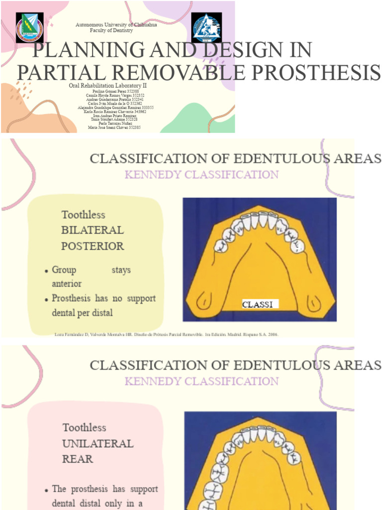 Partial Removable Prosthesis Design Guide | PDF | Prosthesis | Mouth