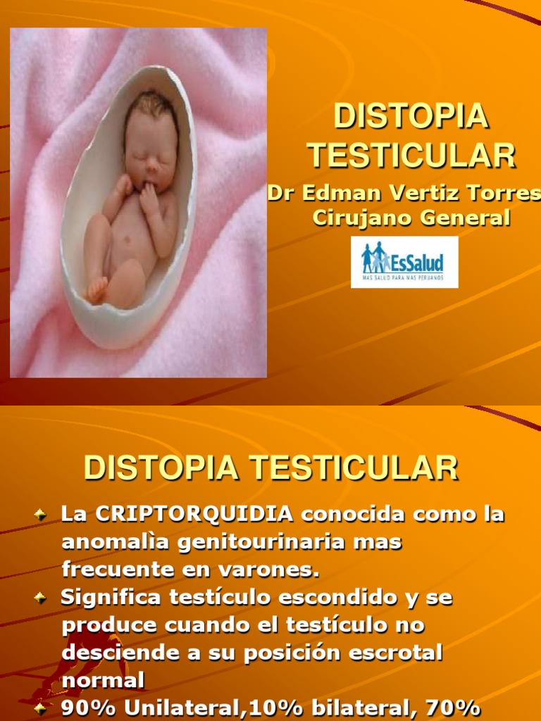 21 Criptorquidea Pdf Testiculo Sistema Endocrino