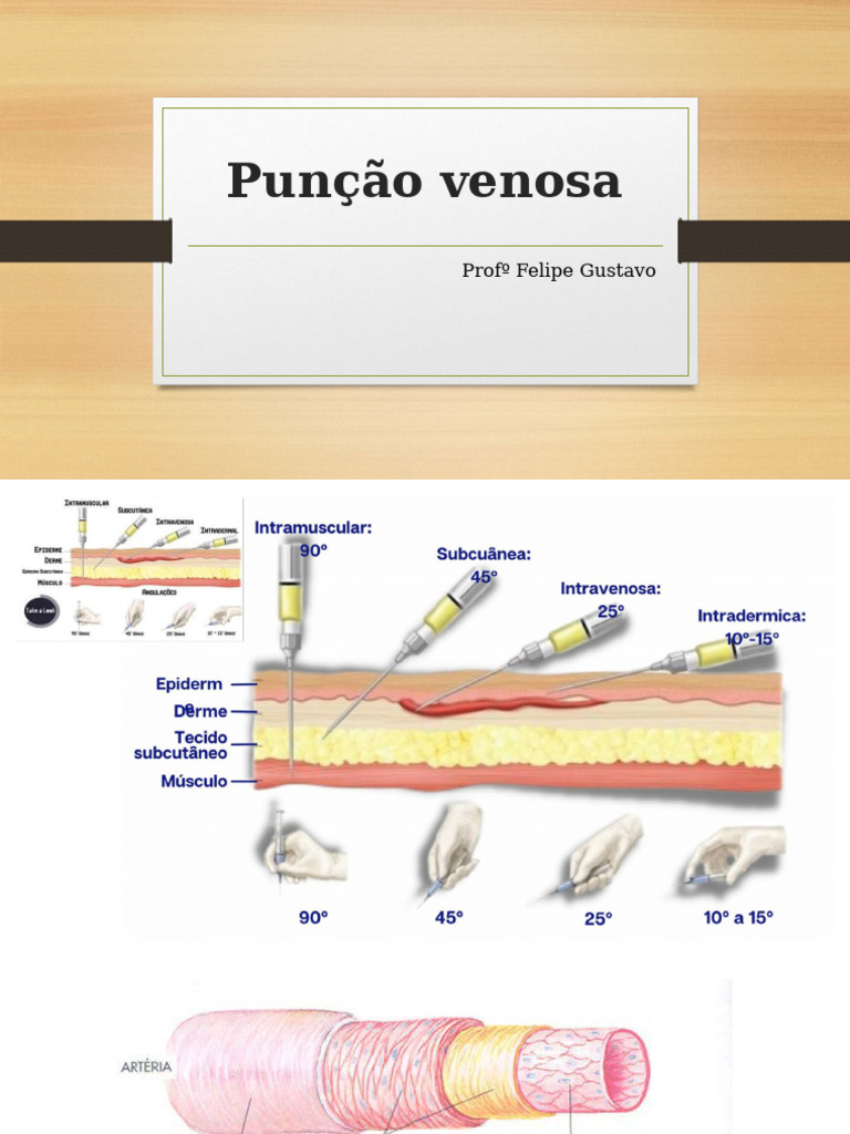 aula 02 Punção Venosa | PDF | Veia | Especialidades médicas