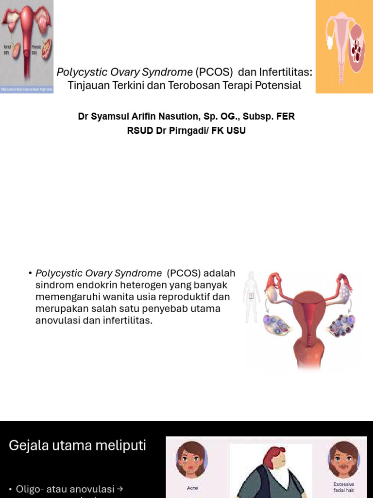 Terapi Infertilitas PCOS Terkini dan Potensial | PDF