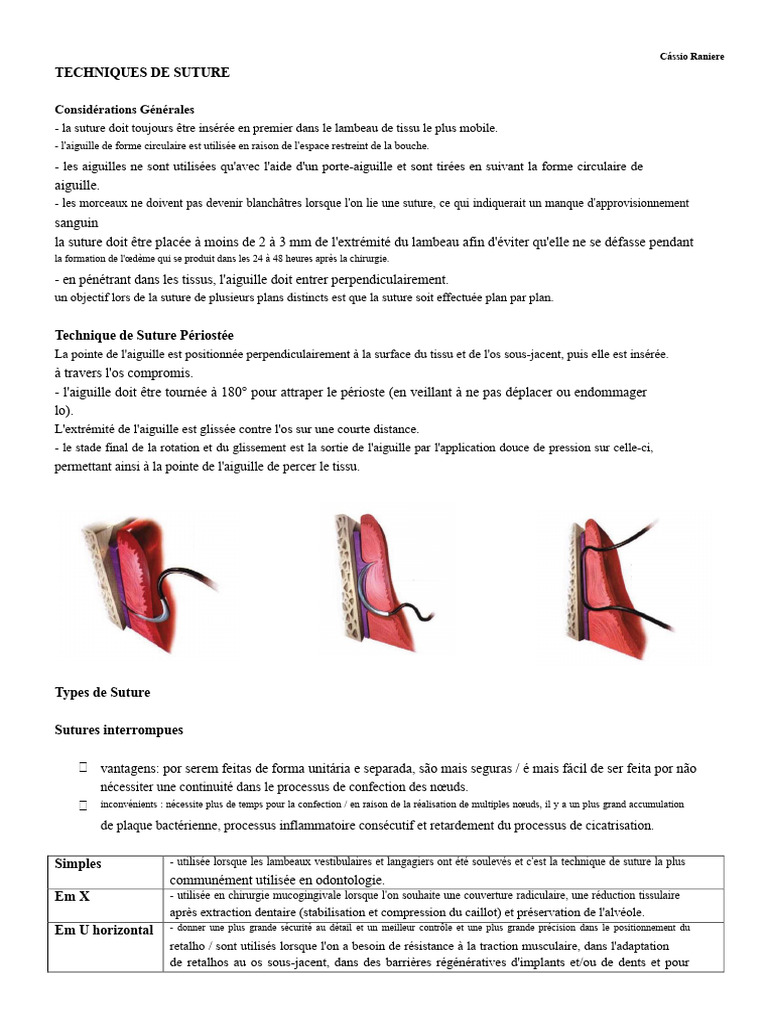 Techniques de Suture en Odontologie | PDF | Suture (médecine)