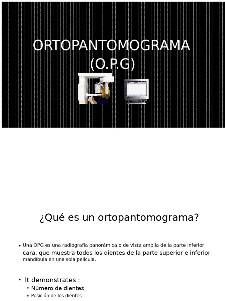 Ortopantomograma: Radiografía Dental Completa | PDF