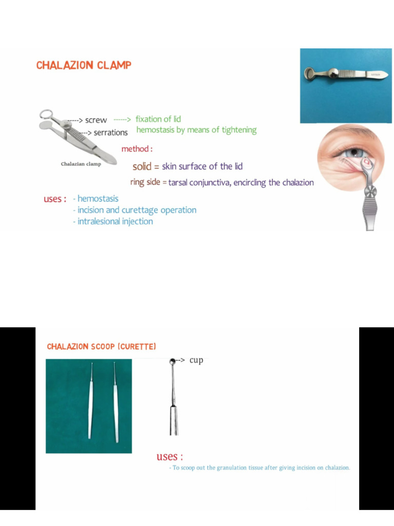 Opthal Instruments | PDF