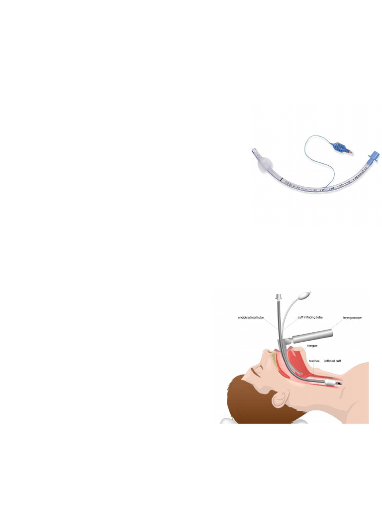 Endotracheal Tube Insertion Guide | PDF