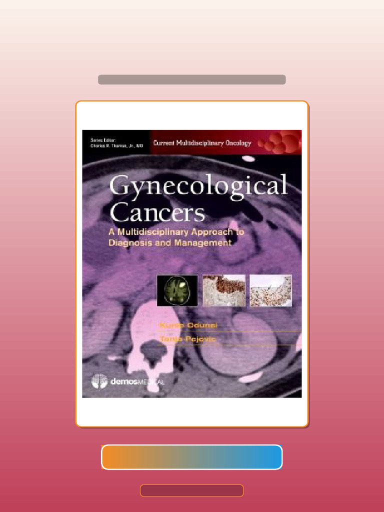 Gynecologic Cancers a Multidisciplinary Approach to Diagnosis and ...