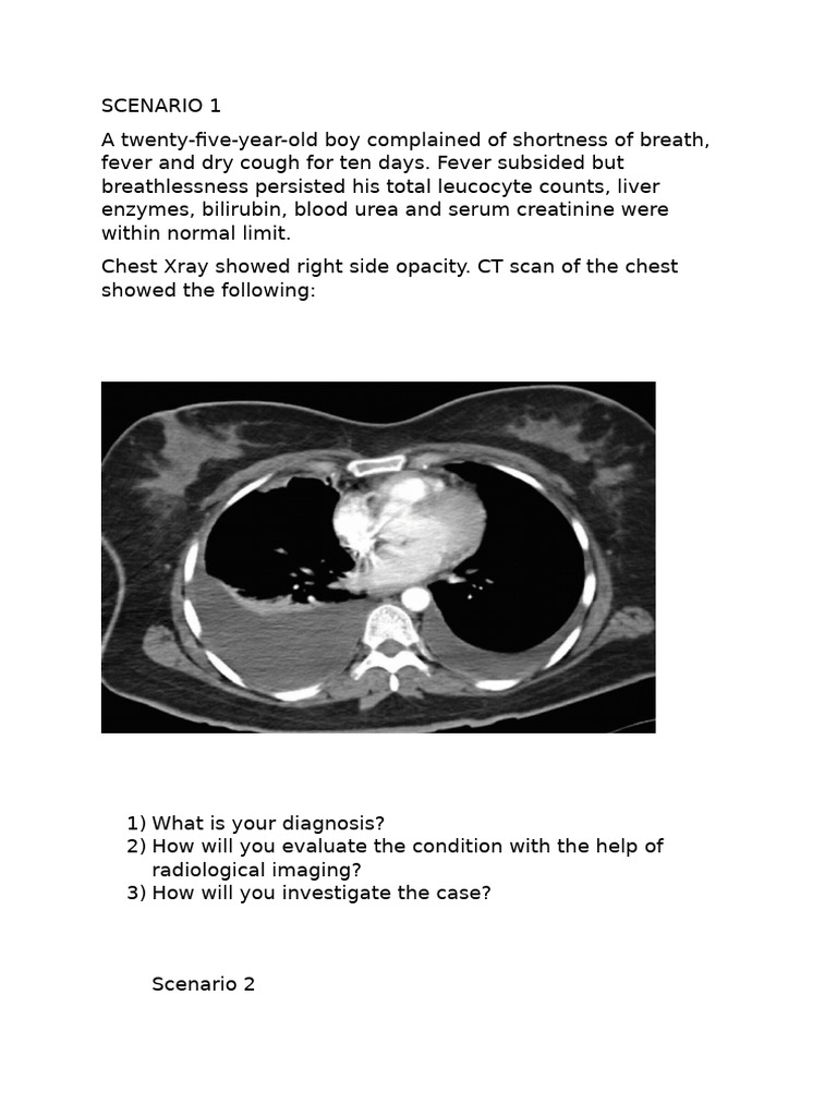 ct chest | PDF | Ct Scan | Medicine