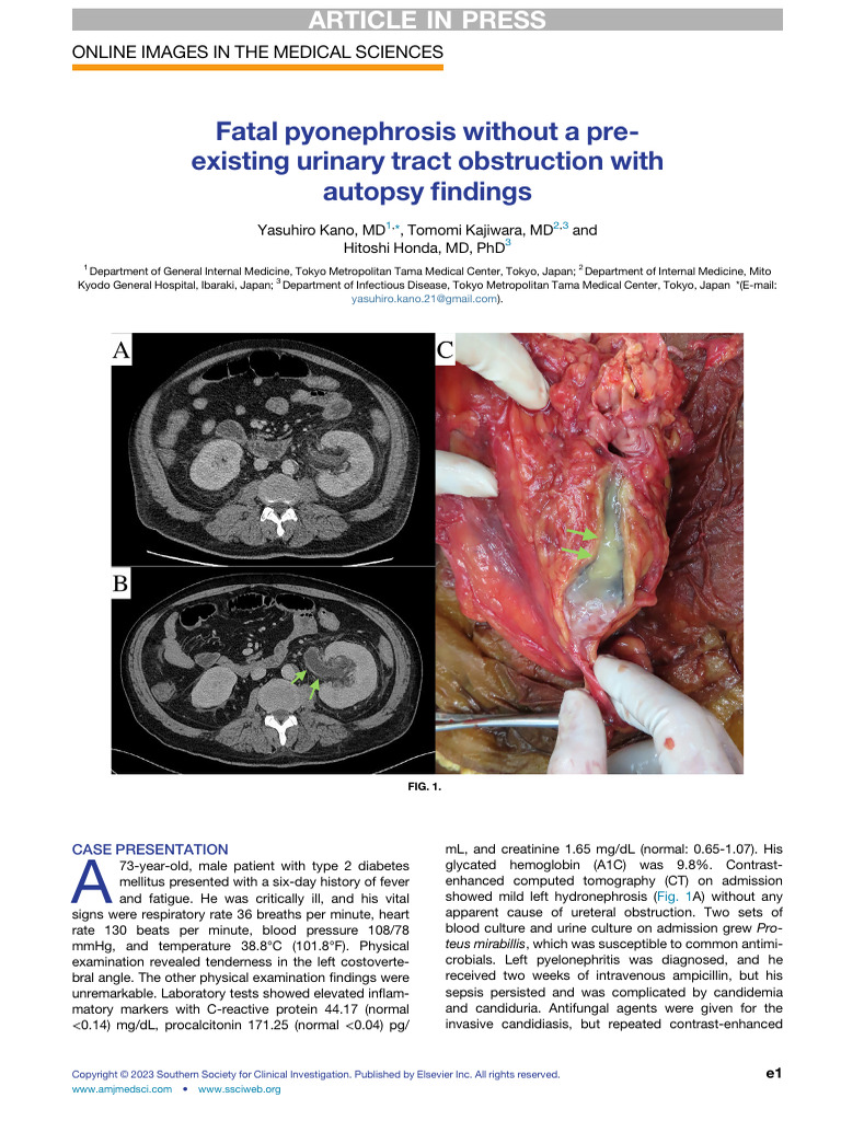 Fatal Pyonephrosis Without A Pre-Existing Urinary Tract Obstruction ...