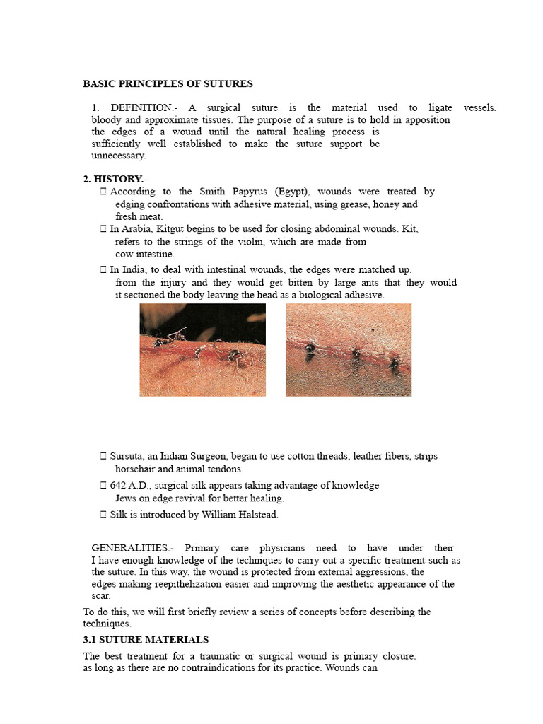 Essential Suture Principles Explained | PDF | Surgical Suture | Wound