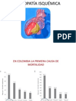Cardiopatia Isquemica