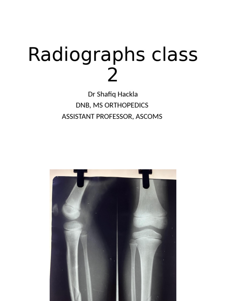 Radiographs Class 2 | PDF