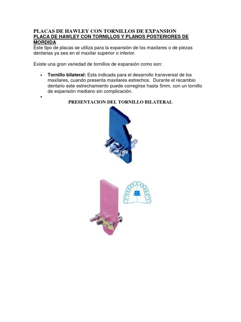 placas-de-hawley-con-tornillos-de-expansion-pdf-diente-humano