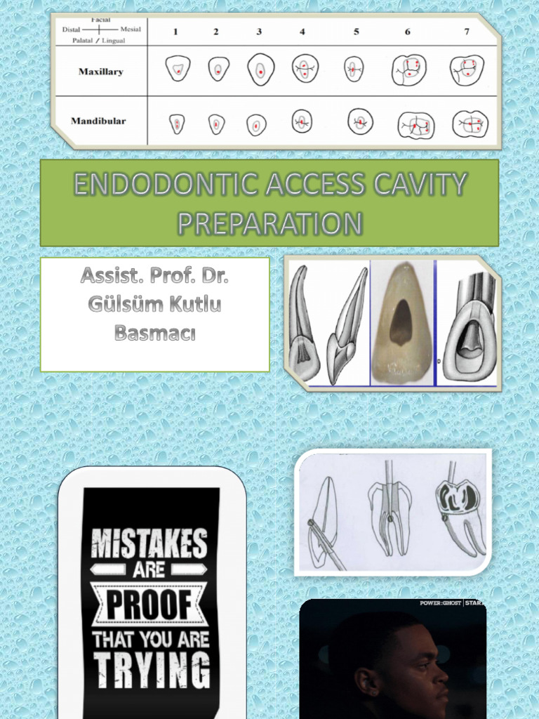 Endodontic Access Cavity Preparation Guide | PDF | Tooth | Dental Anatomy
