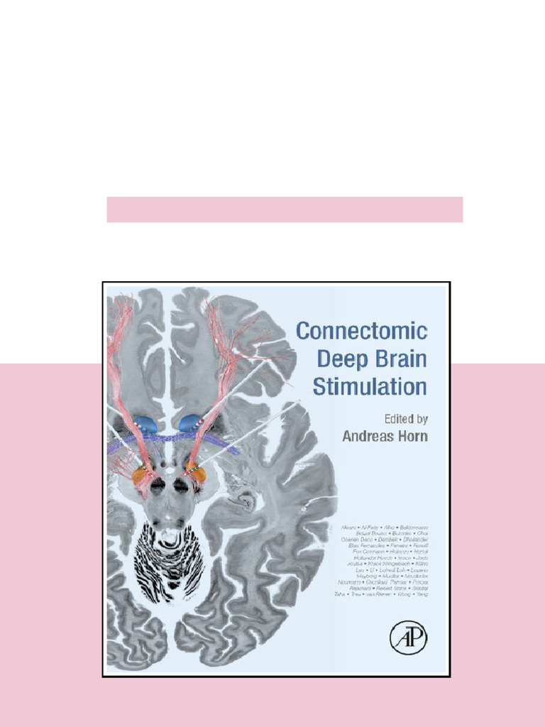 (Ebook) Connectomic Deep Brain Stimulation by Andreas Horn (editor ...