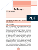 Three Cases of Serious Pathology Fractures Case 1: Ethel
