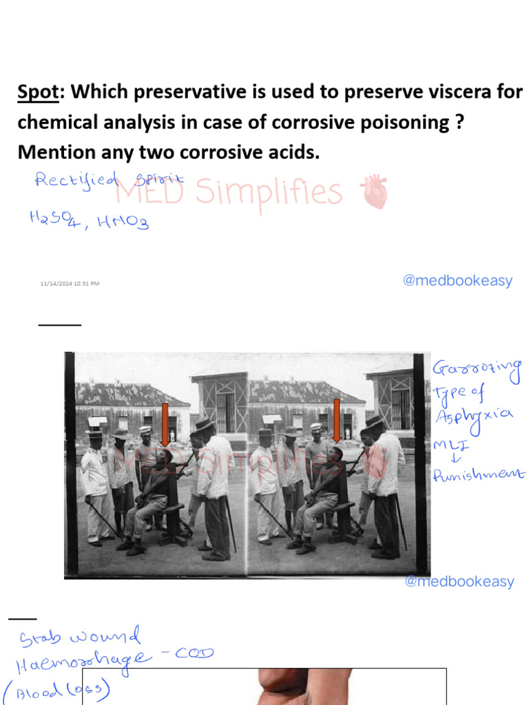 Medicolegal Analysis of Injuries and Poisons | PDF | Medical Specialties