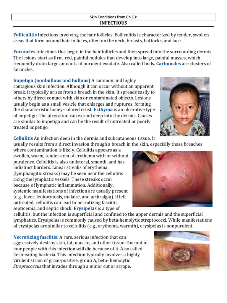 Common Skin Infections and Conditions | PDF | Dermatitis | Allergy