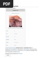 Esophageal Varices