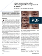 2010 Tsai - Myopexy of the Vertical Rectus Muscles Using Expanded Polytetrafluoroethylene for Management of a Lost Medial Rectus Muscle